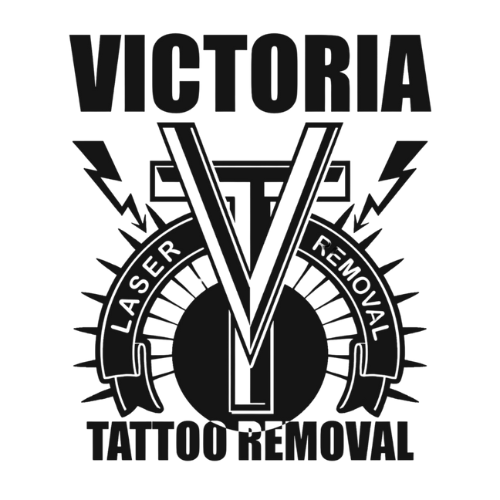 Victoria Tattoo Removal